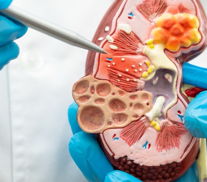 Nephrology